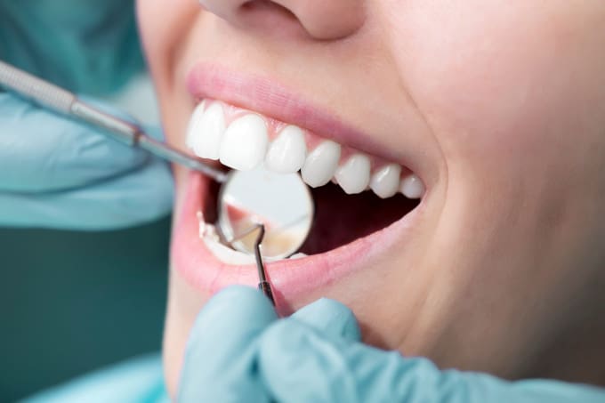dental patient being worked on smiling